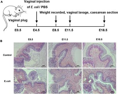 Aerobic Vaginitis Induced by Escherichia coli Infection During Pregnancy Can Result in Adverse Pregnancy Outcomes Through the IL-4/JAK-1/STAT-6 Pathway